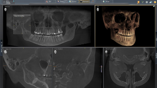 Axeos x-ray 