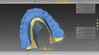 inLab CAD Software, bite splint