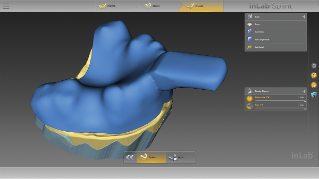 inLab CAD Software, individual impression tray