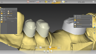 inLab CAD Software, individual primary telescope