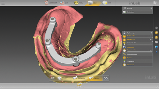 inLab CAD Software, standard bar