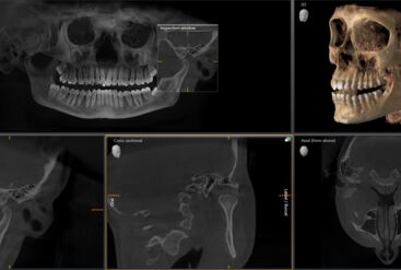 Axeos x-ray 