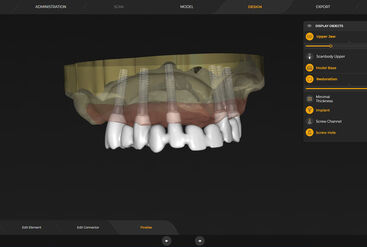 inLab CAD Software, Implantology module, individual abutment on TiBase