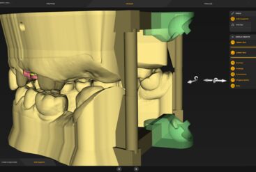 inLab CAD Software, Virtual data model with support structures